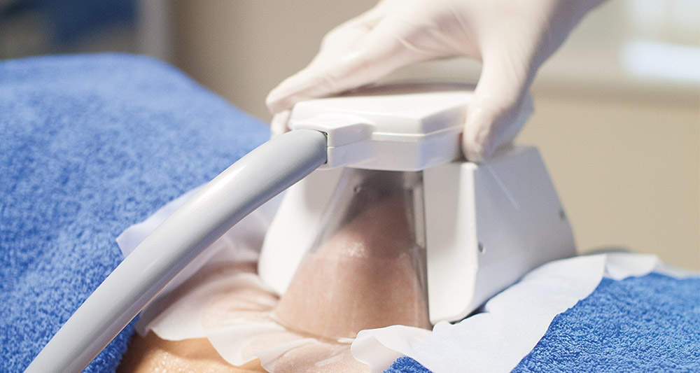 How Fat Freezing and HIFU Work Together? 2 Multiple Areas in One Session HIFU and Fat Freezing Daventry