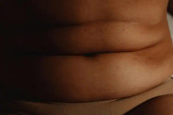 The Hidden Connection: How Stress Shapes Your Fitness and Body Composition 3 image of what stress can do on the stomach area and how Lipo 360 Daventry can help to change your body shape.